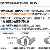 良性発作性頭位めまい症（BPPV）