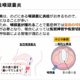 急性喉頭蓋炎