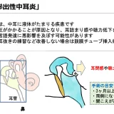 滲出性中耳炎