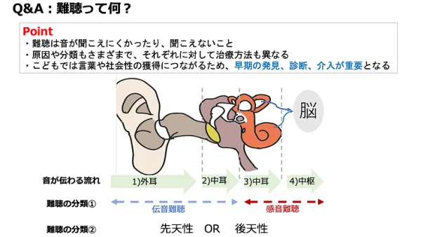 難聴って何？