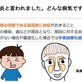 副鼻腔炎と言われました。どんな病気ですか？