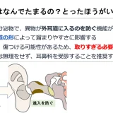 耳垢はなんでたまるの？子供の耳垢はとったほうがいいの？