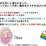 扁桃腺が大きいと言われました。扁桃腺ってなに？大きい場合はどうすればよいの？