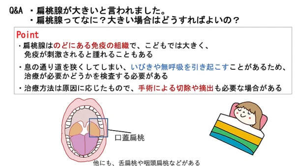 扁桃腺が大きいと言われました。扁桃腺ってなに？大きい場合はどうすればよいの？