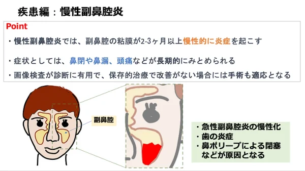 慢性副鼻腔炎