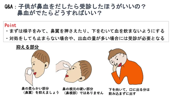 子供が鼻血をだしたら受診したほうがいいの？鼻血がでたらどうすればいい？