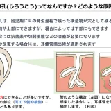 先天性耳瘻孔(じろうこう)ってなんですか？どのような原因で起こりますか？