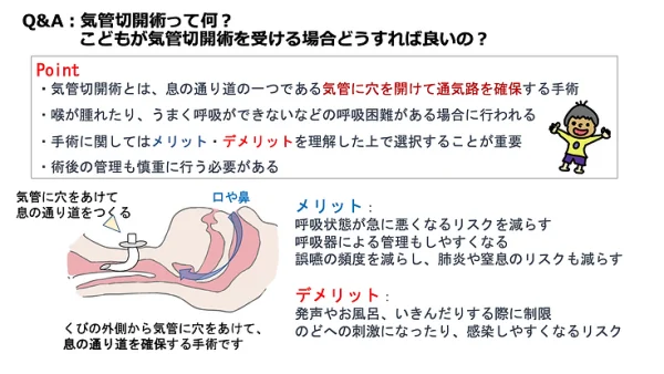 気管切開術って何？こどもが気管切開術を受ける場合どうすれば良いの？