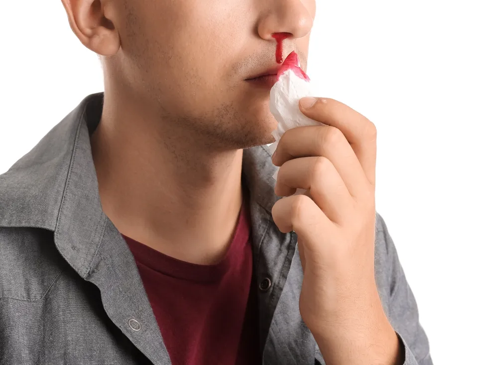 若年性血管線維腫の主な症状