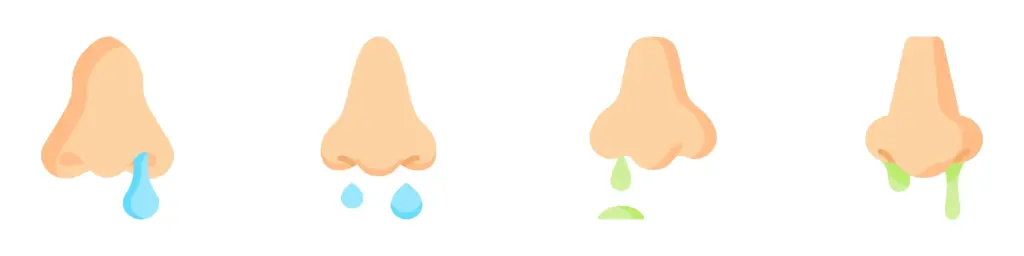 副鼻腔炎の主な症状