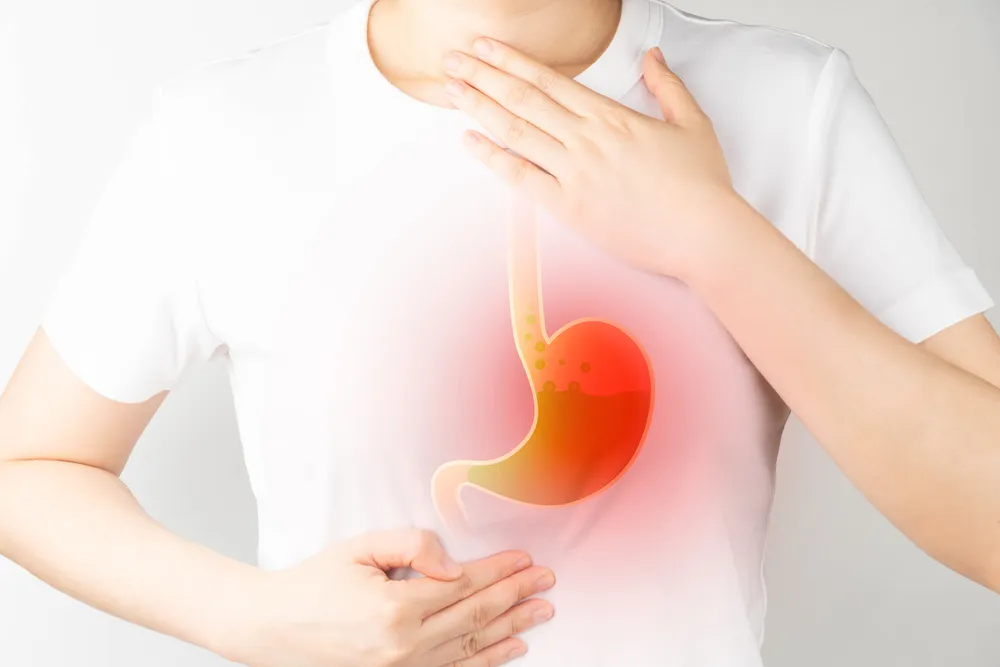 逆流性食道炎について。耳鼻科で行うファイバースコープ検査